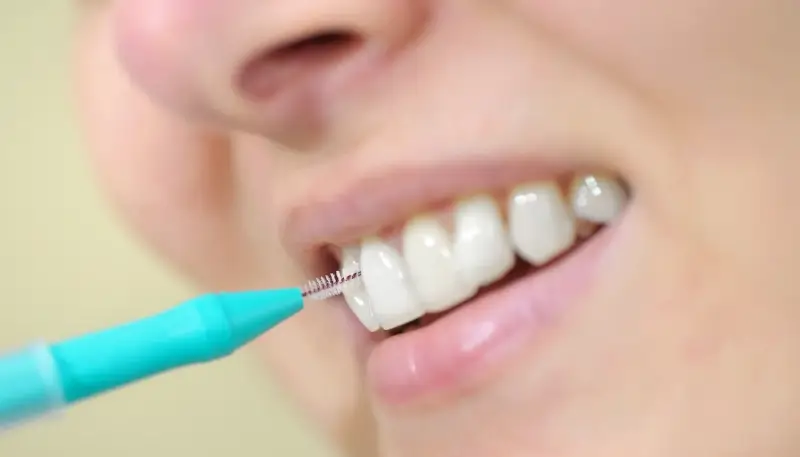 Najlepszy licówki porcelanowe Szczecin