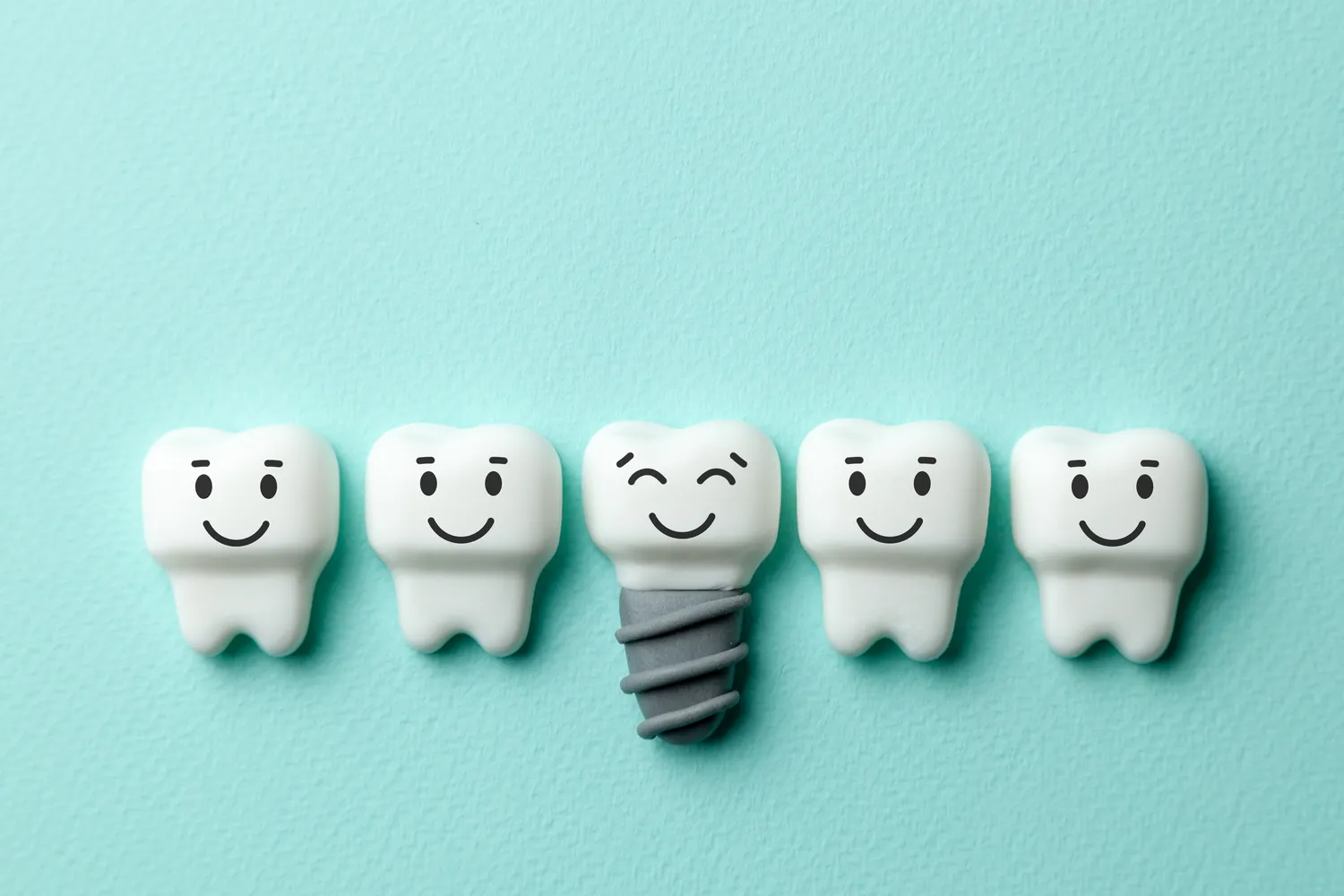 Jak się przygotować do wszczepienia implantów zębów?