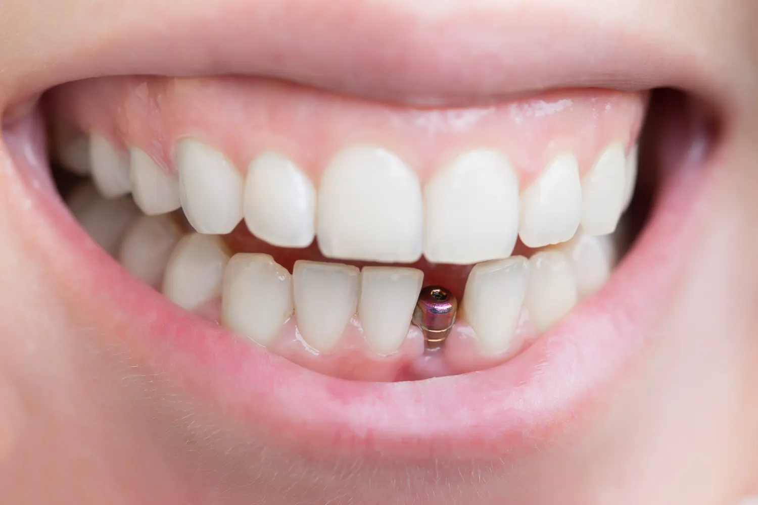 Dentysta reklama