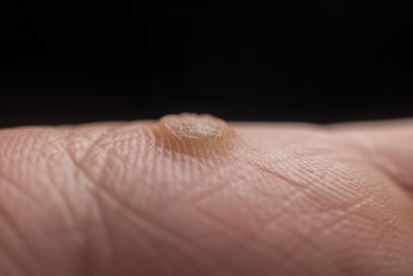 Podologia, czyli jak pozbyć się problemów ze stopami?